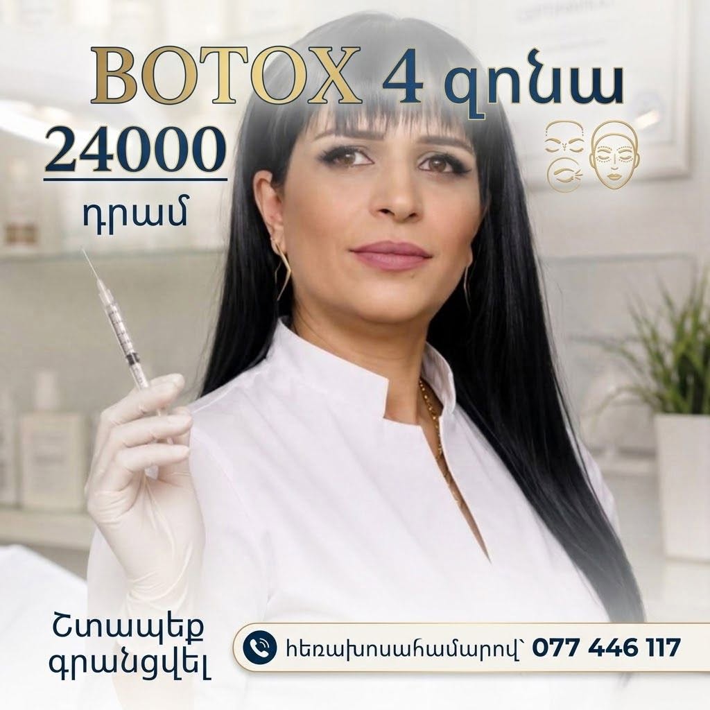 Botox 4 zones, 24000 AMD