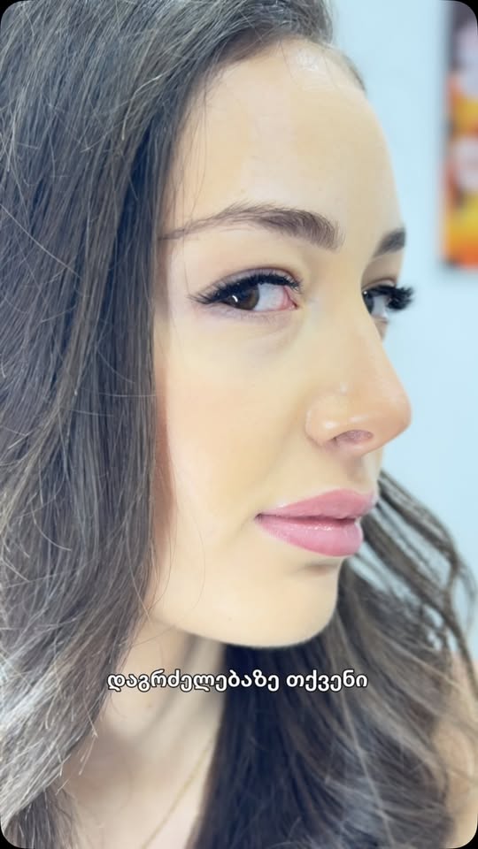 Extension of eyelashes in Varkezeli